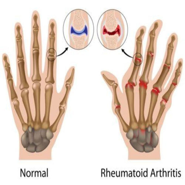 Compression Therapy Active Gloves - Copper Hands